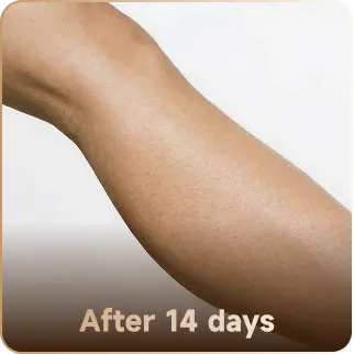 After 14 days