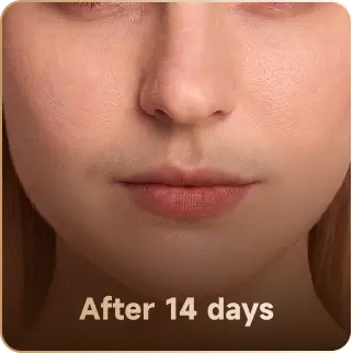After 14 days