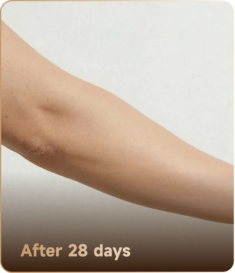 After 28 days