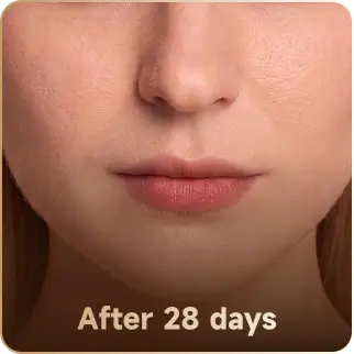 After 28 days