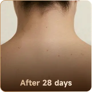 After 28 days